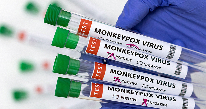 Study finds 95% of monkeypox cases transmitted through sexual activity